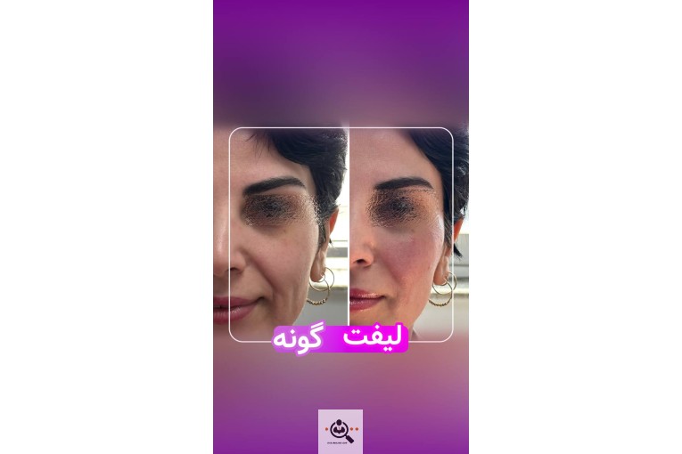 کلینیک نلا در رشت