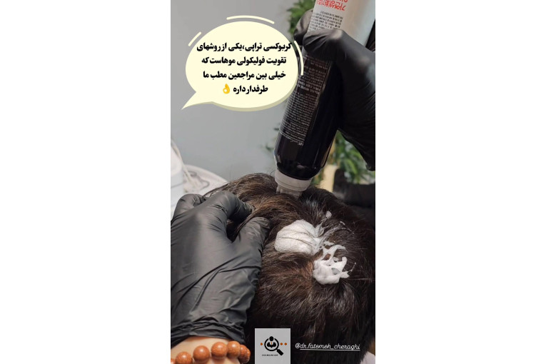 میکرواسکالپ مریم درویشی در اهواز