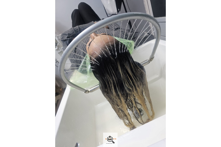 میکرواسکالپ مریم درویشی در اهواز