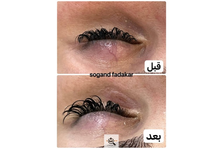 فیشال و پاکسازی صورت سوگند فداکار در تهران