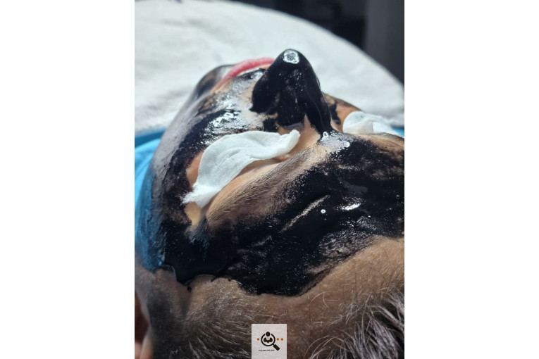 فیشال و پاکسازی صورت سوگند فداکار در تهران