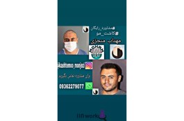 کاشت مو مهتاب منجزی در اهواز