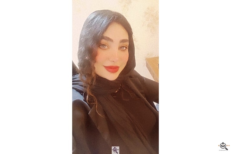 کاشت مو مهتاب منجزی در اهواز