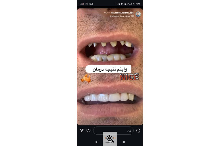 پروتز دندانی و لمینت نبی زاده در تبریز