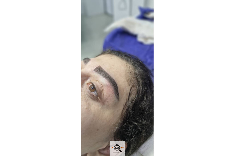 کاشت ابرو مددی در مشهد