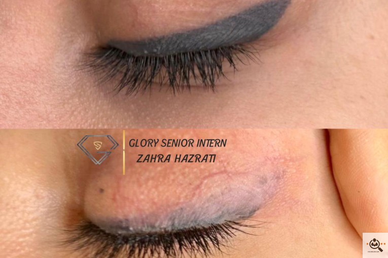 آرایش دائم و ریمو زهرا حضرتی در آذربایجان غربی
