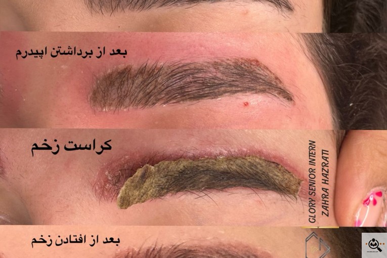 آرایش دائم و ریمو زهرا حضرتی در آذربایجان غربی