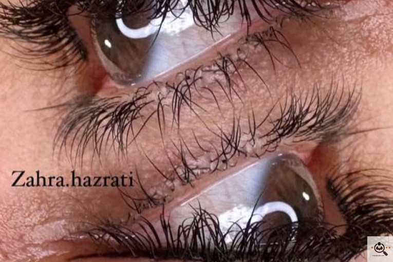 آرایش دائم و ریمو زهرا حضرتی در آذربایجان غربی
