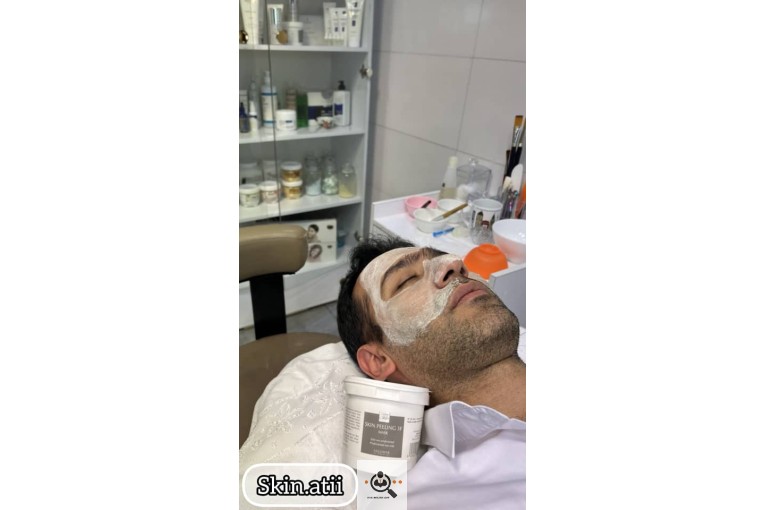 فیشال صورت عاطفه امیری در غرب تهران