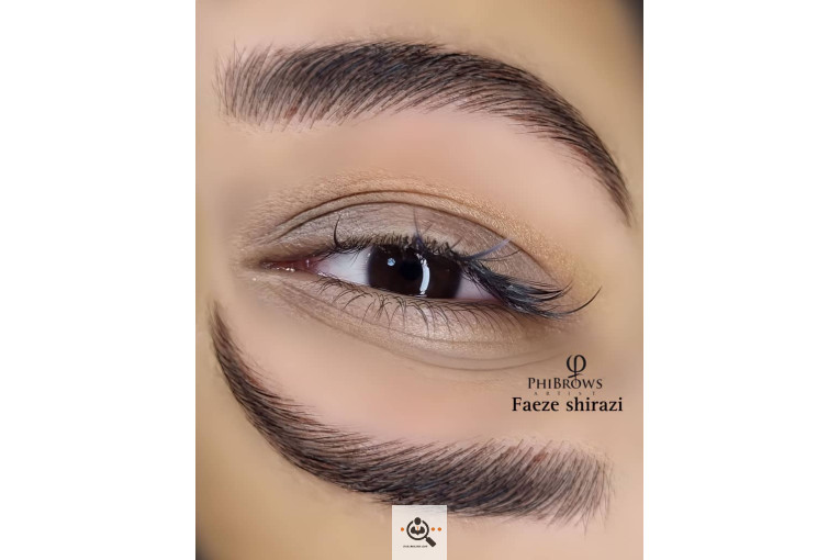 میکروبلیدینگ و فیبروز فائزه شیرازی در شیراز