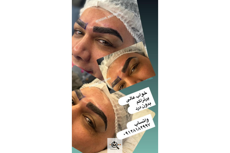 کاشت ابرو حرفه ای مازندران فرزانه محمدپور