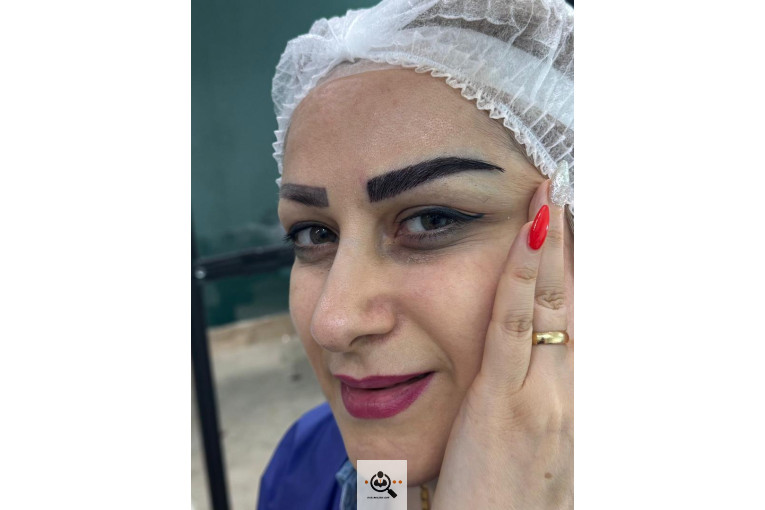 کاشت ابرو حرفه ای مازندران فرزانه محمدپور
