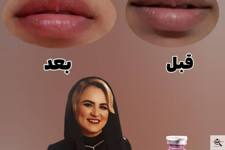 کلینیک زیبایی پوست و فیشال مژگان صالحی در تهران