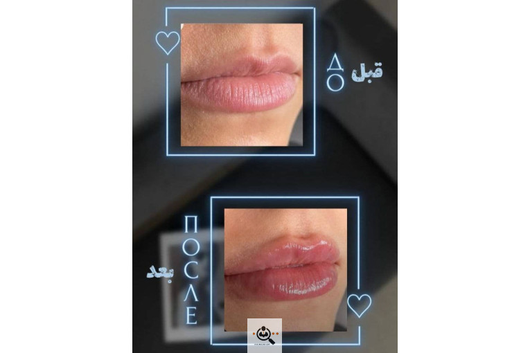 کلینیک زیبایی پوست و فیشال مژگان صالحی در تهران