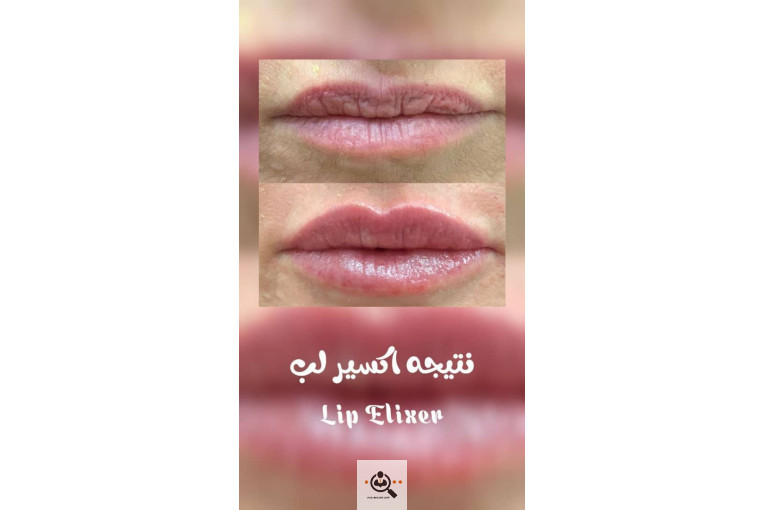 کلینیک زیبایی پوست و فیشال مژگان صالحی در تهران