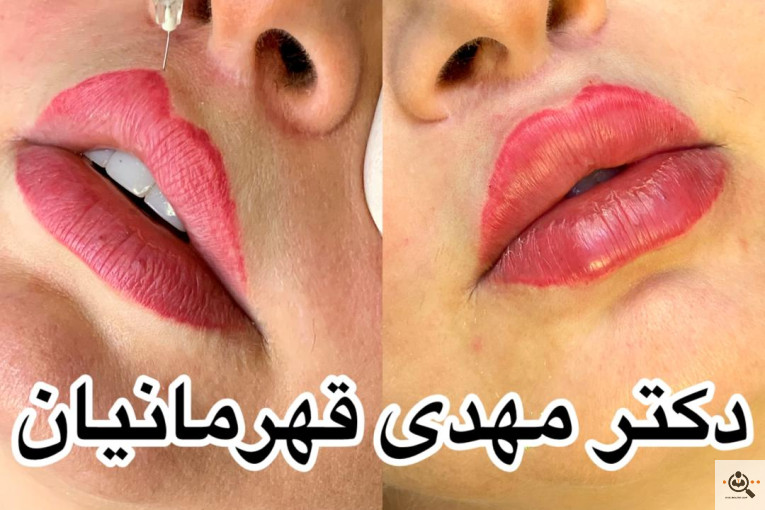 کلینیک پوست و مو دکتر مهدی قهرمانیان (آفرینش) 