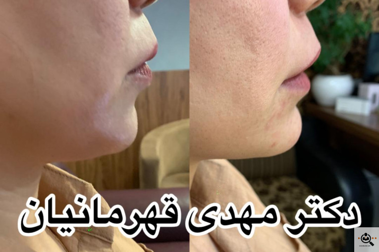 کلینیک پوست و مو دکتر مهدی قهرمانیان (آفرینش) 