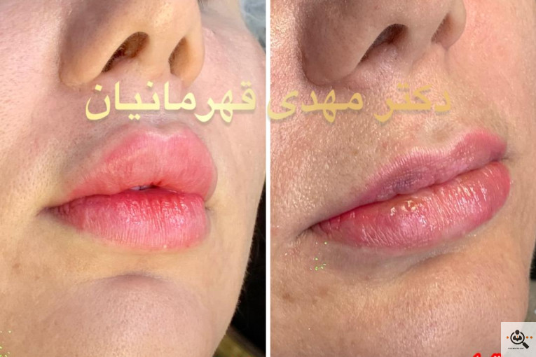 کلینیک پوست و مو دکتر مهدی قهرمانیان (آفرینش) 