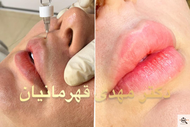 کلینیک پوست و مو دکتر مهدی قهرمانیان (آفرینش) 