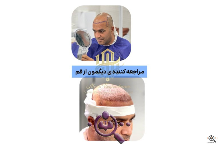 بهترین مجری و مرکز تخصصی کاشت مو در تهران و  شیراز 
