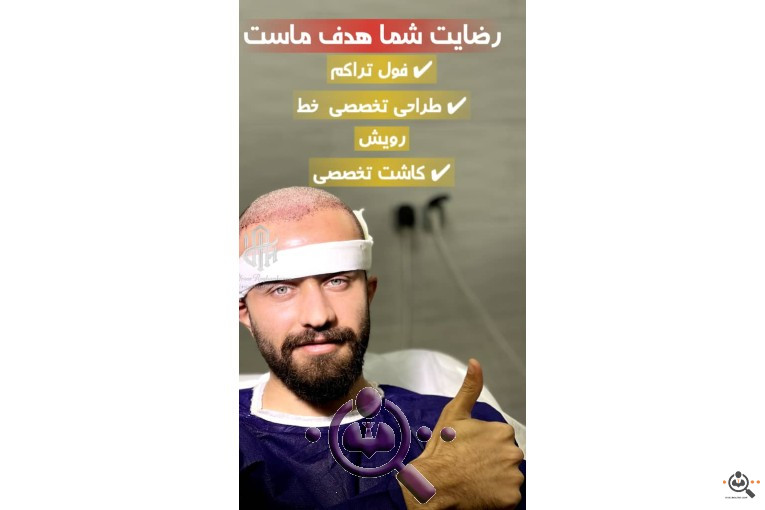 بهترین مجری و مرکز تخصصی کاشت مو در تهران و  شیراز 