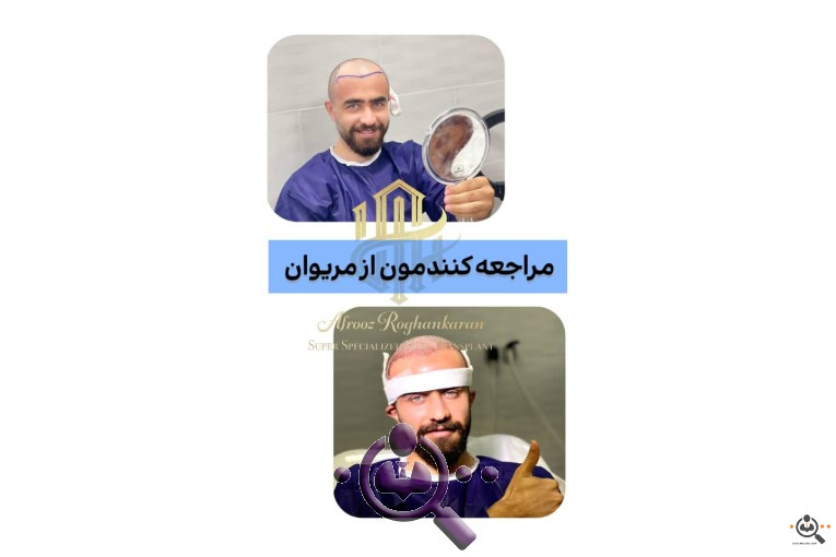 بهترین مجری و مرکز تخصصی کاشت مو در تهران و  شیراز 