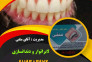 لابراتوار دندانسازی متقی در رشت