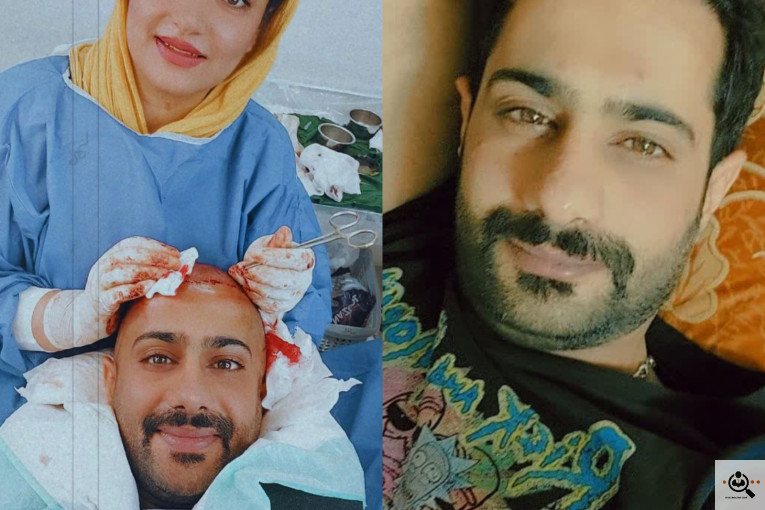 اولین و بهترین کاشت مو تخصصی در یزد