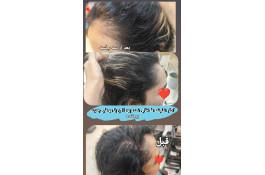 اسکراب اسکالپ سمیه شعبانی در شیراز