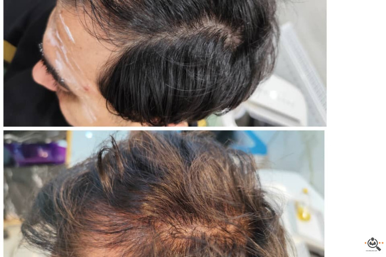 اسکراب اسکالپ سمیه شعبانی در شیراز
