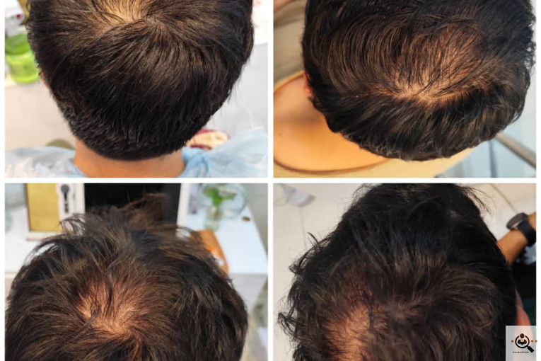 اسکراب اسکالپ سمیه شعبانی در شیراز