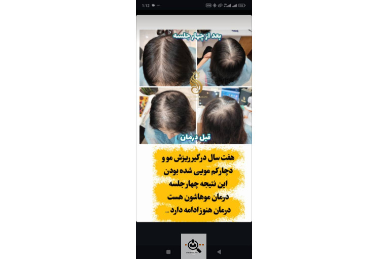 اسکراب اسکالپ سمیه شعبانی در شیراز