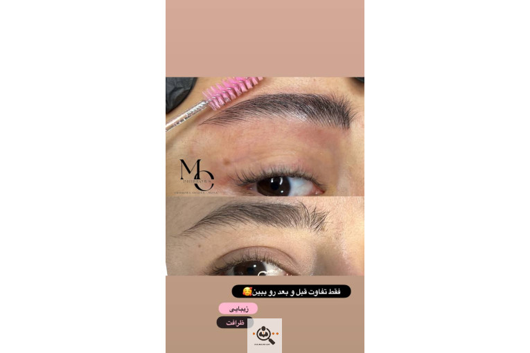 خدمات میکروبلیدینگ مونا طوافیان در آبادان