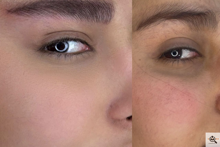 خدمات میکروبلیدینگ مونا طوافیان در آبادان