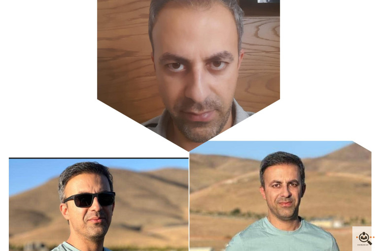 کاشت مو مریم عباسی در شیراز