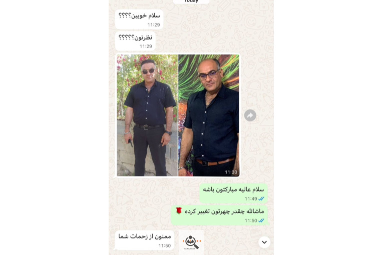 کاشت مو مریم عباسی در شیراز