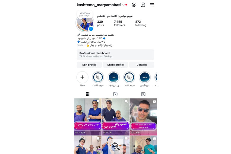 کاشت مو مریم عباسی در شیراز