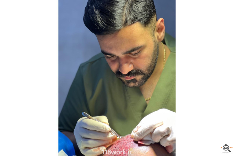 خدمات تخصصی کاشت مو و ابرو شفائی در رشت