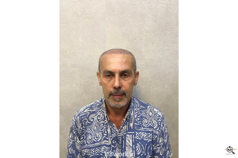 خدمات تخصصی کاشت مو و ابرو شفائی در رشت