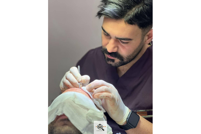 خدمات تخصصی کاشت مو و ابرو شفائی در رشت