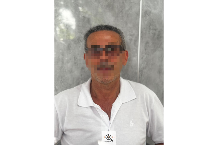 خدمات تخصصی کاشت مو و ابرو شفائی در رشت