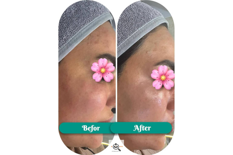 فیشال و پاکسازی جانا در بوشهر