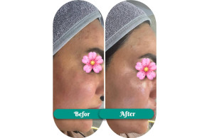 فیشال و پاکسازی جانا در بوشهر