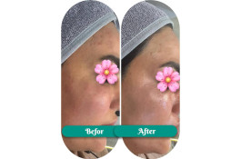 فیشال و پاکسازی جانا در بوشهر