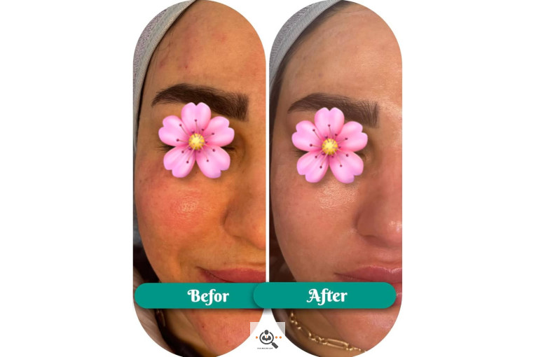 فیشال و پاکسازی جانا در بوشهر