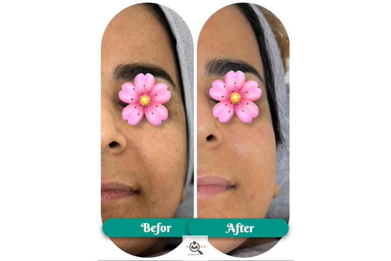 فیشال و پاکسازی جانا در بوشهر