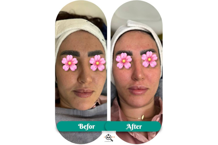 فیشال و پاکسازی جانا در بوشهر