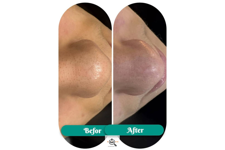 فیشال و پاکسازی جانا در بوشهر