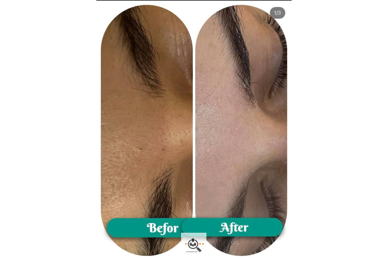 فیشال و پاکسازی جانا در بوشهر