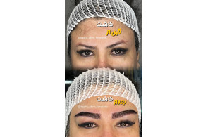 بهترین کاشت ابرو و میکروکاشت در شیراز